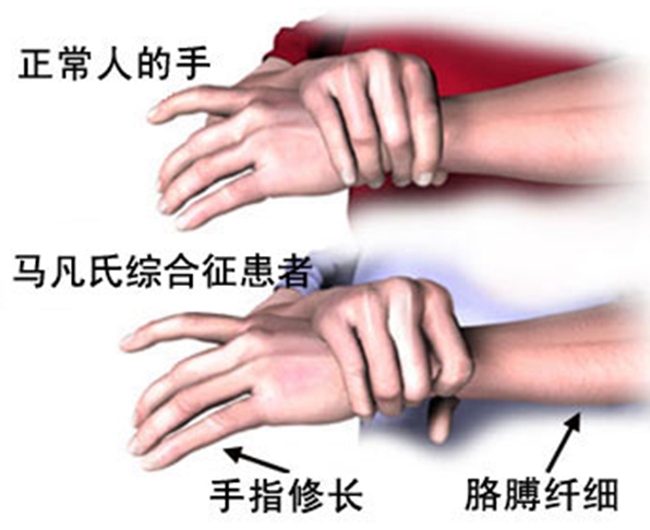 1499936442578670.png 2.png