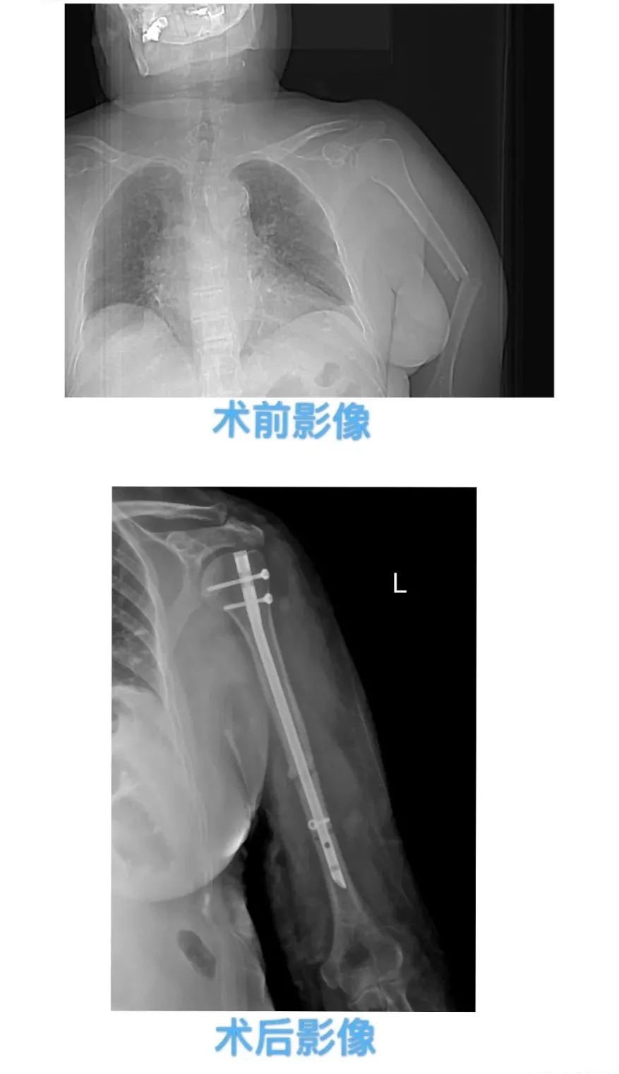 1611044166438013.jpg